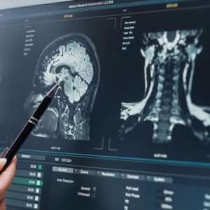 Read more about the article Health Officials Delayed Report Linking Fluoride to Brain Harm