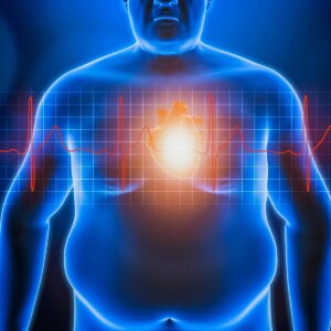 Read more about the article Fat Growing Around Muscles Could Be a Silent Killer