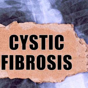 Read more about the article Natural Therapies for Cystic Fibrosis