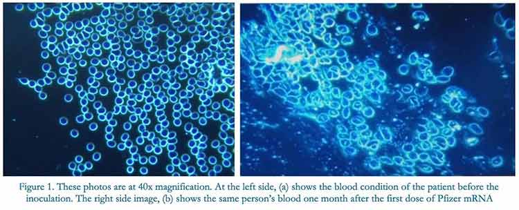 blood condition