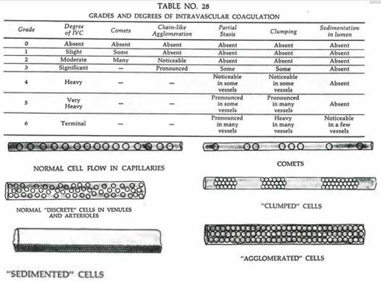 grades and degress of intravascular coagulation